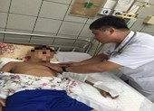 Cha mẹ đắp lá, đậu lào chữa rắn cắn khiến con nguy kịch