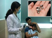 Cảnh báo trẻ bị thủng mũi, màng nhĩ từ pin đồ chơi