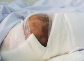 Uống thuốc truyền miệng, bệnh nhân tiểu đường mất mạng