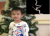 Bé trai 3 tuổi đột quỵ vì nguyên nhân không ngờ