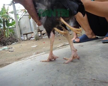 Đôi chân thừa mọc sát phía sau đôi chân chính