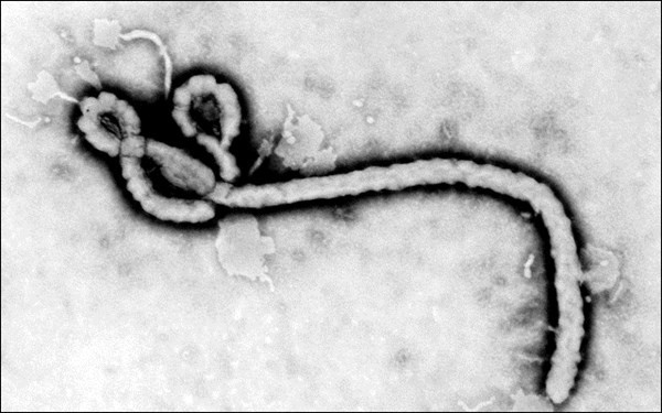 Virus Ebola đã xuất hiện từ 38 năm trước?