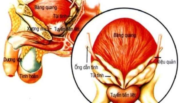 Bệnh tuyến tiền liệt, chớ coi thường