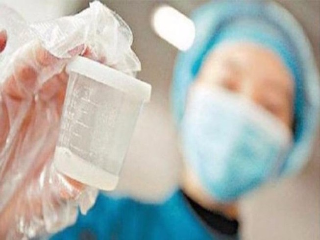 Màu sắc tinh dịch, khi nào là bệnh?