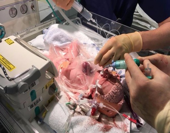 Bé gái tim ngoài lồng ngực sống sót thần kỳ