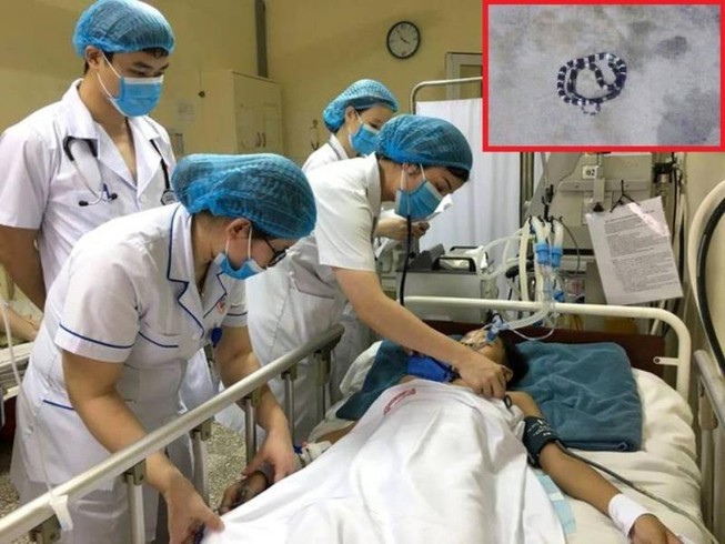 Đi soi cóc bị rắn cạp nia cắn, bé trai nguy kịch