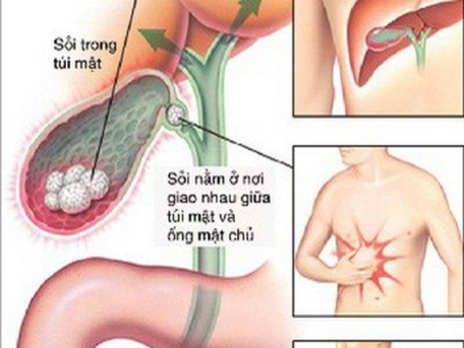 (Hình minh họa)