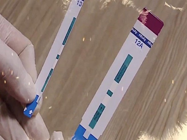 Vụ gian lận xét nghiệm HIV: Cục Phòng chống HIV/AIDS lên tiếng
