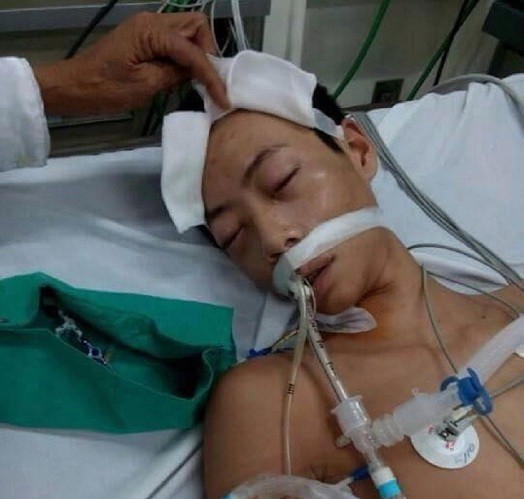 Nghi can 17 tuổi tử vong do bị hành hung