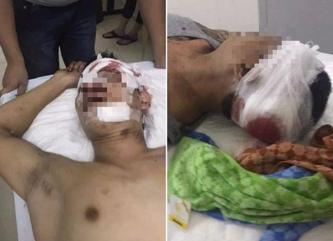 2 thanh niên bị nhóm 10 người cầm tuýp sắt truy sát