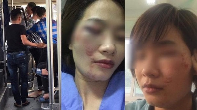 Truy nã 2 thanh niên đánh bầm dập nữ nhân viên xe buýt