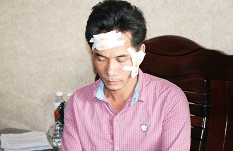 Tổ trưởng bảo vệ dân phố bị tố đánh rách mặt người dân