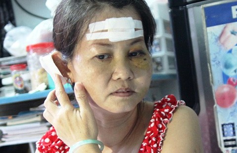 Đừng để dân đơn độc khi đã cầu cứu