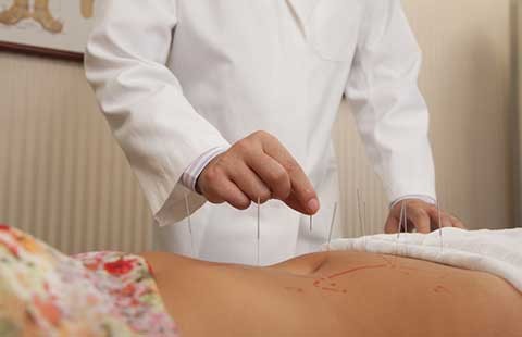 Châm cứu tốt cho trí nhớ