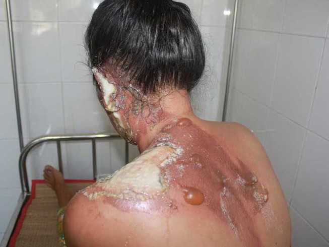 Những trận đòn từ ‘người đàn ông của cuộc đời’