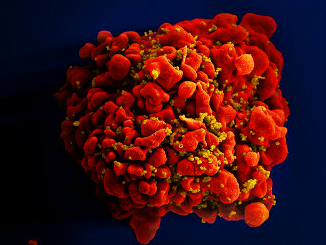 Em bé thứ ba trên thế giới được chữa khỏi HIV