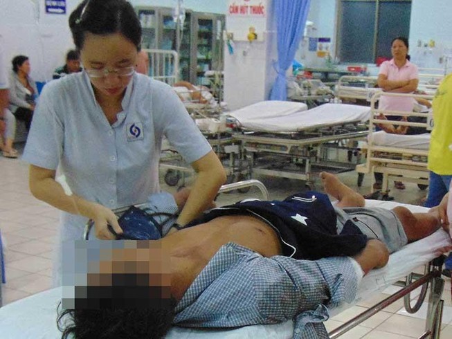 Chấn thương sọ não dính tới rượu bia trong ngày nghỉ lễ