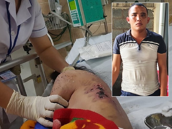 Lời khai kẻ đánh nữ nhân viên từ chối kích dục