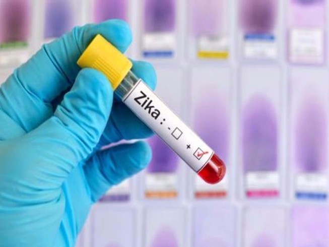 Phát hiện ca nhiễm virus Zika đầu tiên ở Vĩnh Long