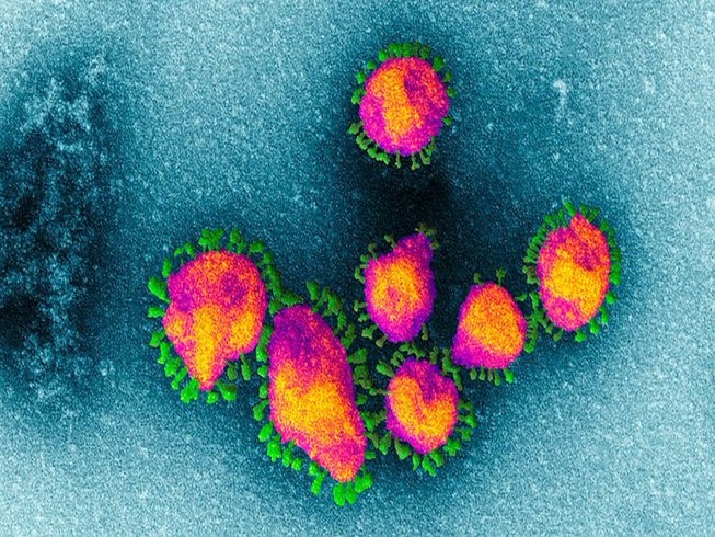 Không chặn được đà lây nhanh sẽ không kiểm soát nổi dịch virus corona. Ảnh: EYE OF SCIENCE