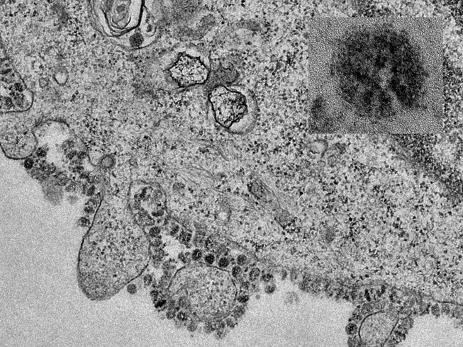 Đại học Hong Kong công bố những hình ảnh đầu tiên về quá trình phân bào của virus 2019-nCoV. Ảnh: BLOOMBERG