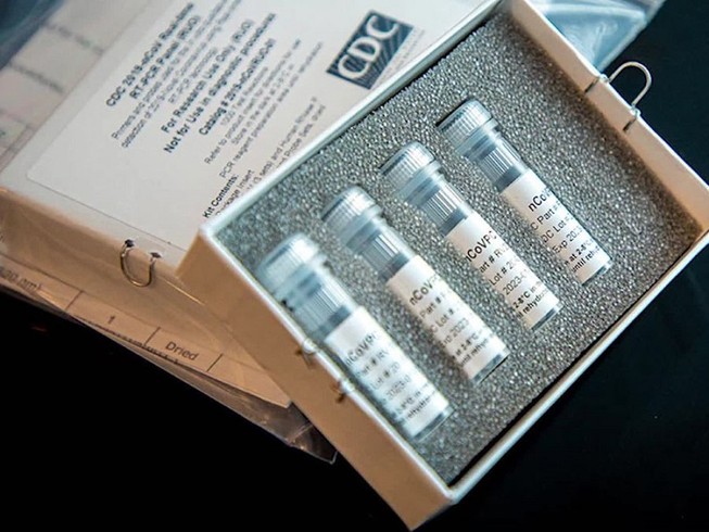 Mỹ đang rất cần các bộ kit xét nghiệm để xét nghiệm COVID-19 cho dân. Ảnh: CDC