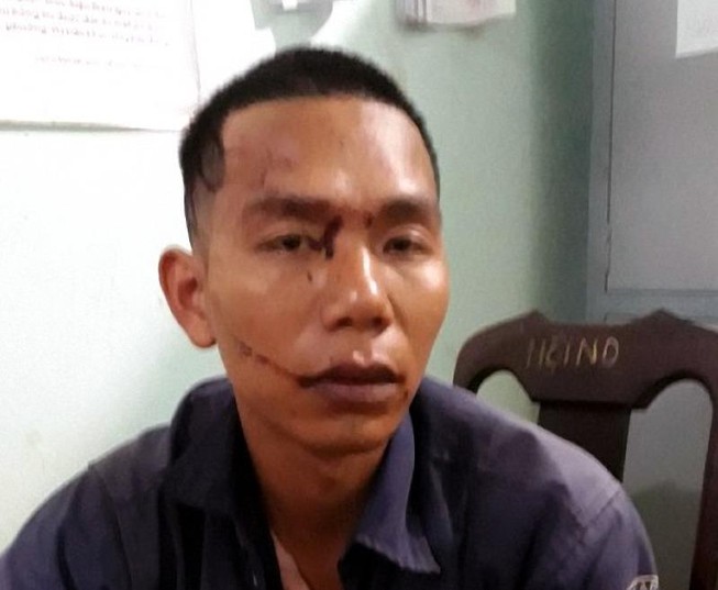 Bắt tại trận vợ ngoại tình, chồng chém tử vong tình địch