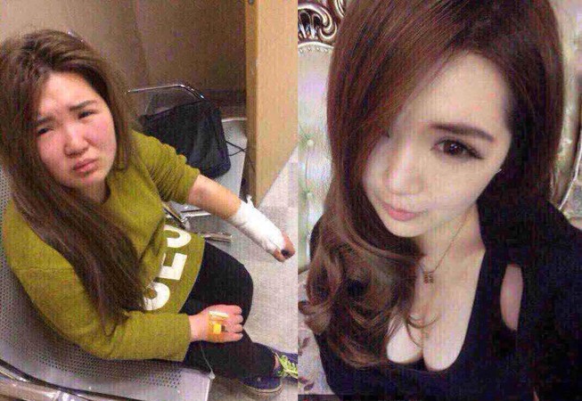 Thiếu nữ bị bạn trai đánh dã man vì xấu hơn trên mạng