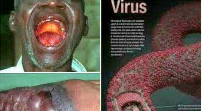 10 thắc mắc không thể bỏ qua về bệnh dịch chết người Ebola