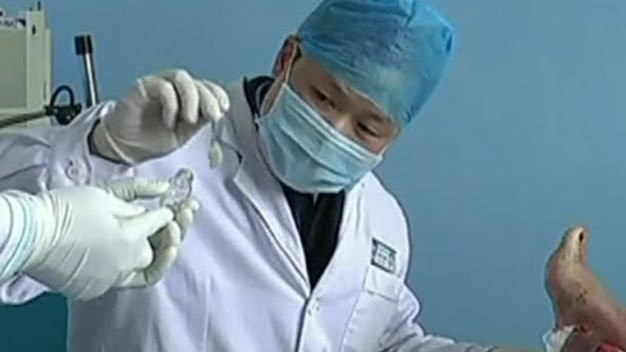 Dùng giòi điều trị bệnh tiểu đường
