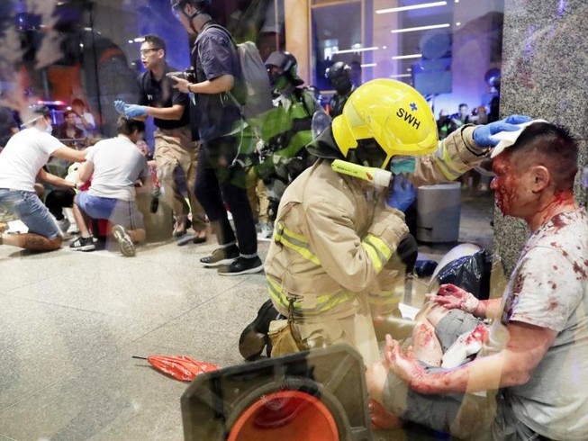 Hong Kong: Cãi vã chính trị, nhiều người bị đâm nguy kịch