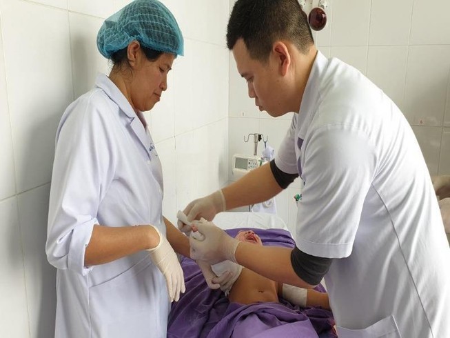 2 trẻ nhập viện vì bỏng nước sôi và nước lẩu