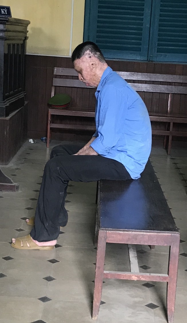Bị tẩm xăng đốt chết vì muốn chia tay với người tình