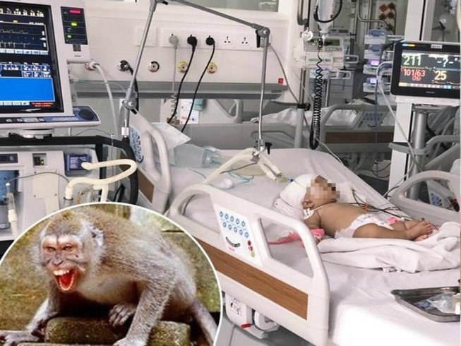 Kinh hoàng bé 14 tháng tuổi bị khỉ cắn rách đầu nguy kịch