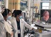 Nhập viện vì vệ sinh răng bằng tăm bông tự chế