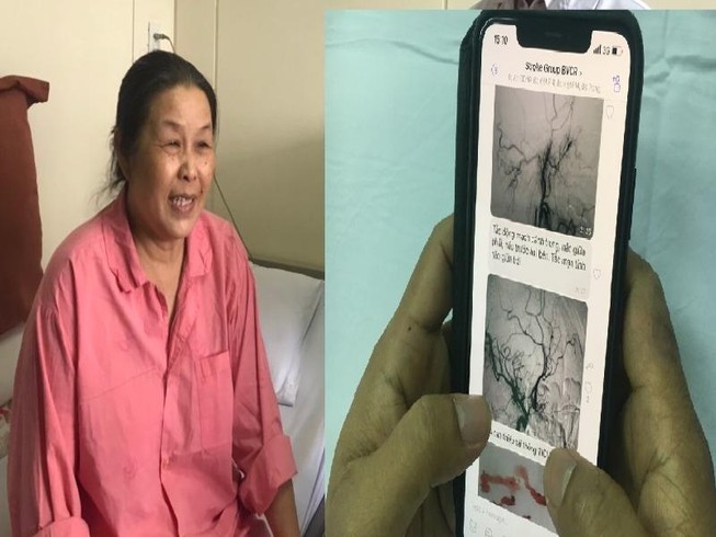 Bác sĩ trao đổi qua viber cấp cứu thần tốc bệnh nhân đột quỵ