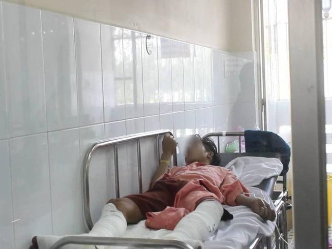 Tay chiết xăng miệng ngậm thuốc lá, 4 người bỏng nặng