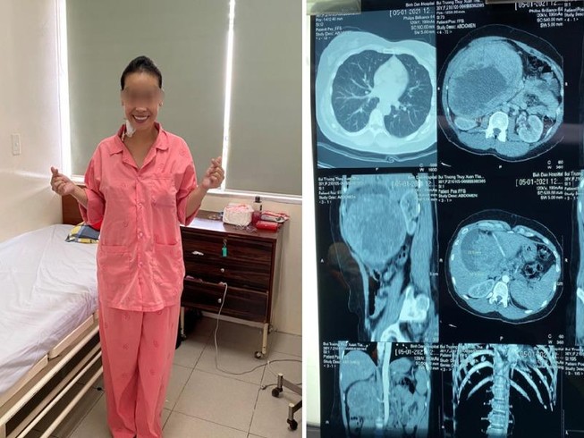 Đau như bị ai đâm sau lưng nhưng tưởng thủ phạm là mỡ