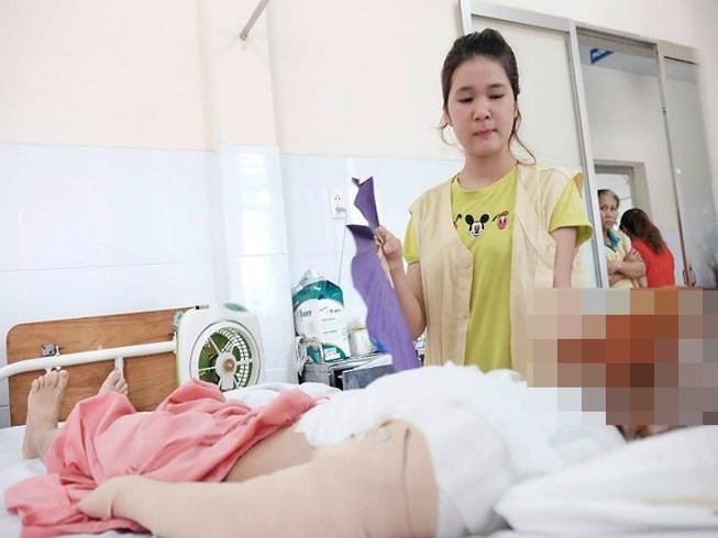Bắt kẻ tạt axit huỷ hoại khuôn mặt cô gái 17 tuổi