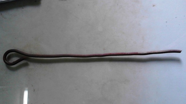 Cậu bé 11 tuổi bị thanh sắt 40cm đâm xuyên hậu môn