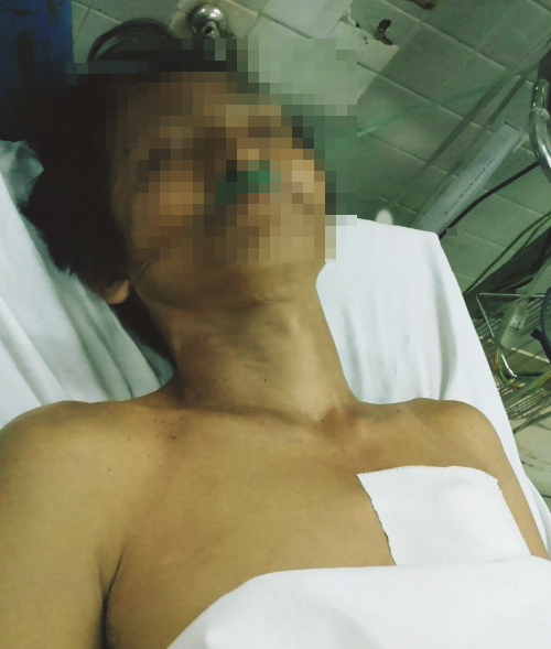 Truy tìm người phụ nữ chém nhân tình gục xuống bên đường