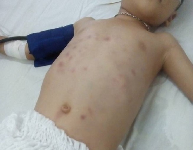Bé 5 tuổi bị người tình của mẹ đánh nhập viện