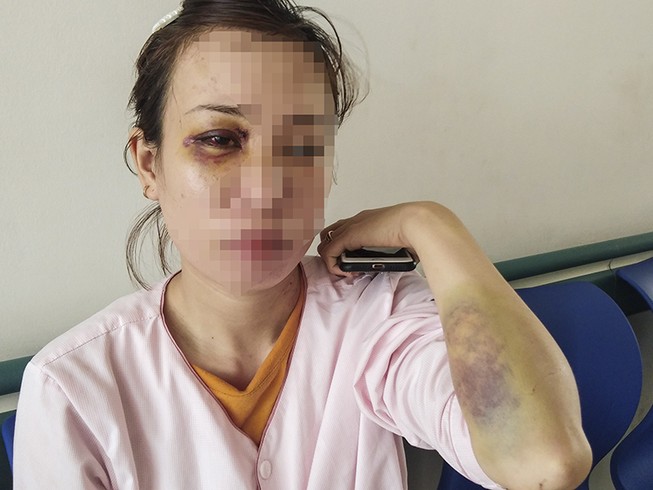 Người phụ nữ mang thai bị hàng xóm hành hung phải nhập viện