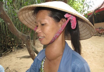 Bệnh tự miễn: “Nội chiến” trong cơ thể