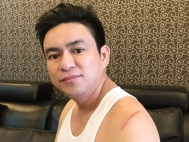 Vụ BS Chiêm Quốc Thái bị giang hồ chém: Bắt người vợ