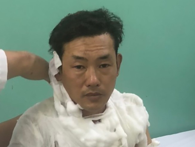 Thanh niên cướp ngân hàng ở Bình Tân gây án như thế nào
