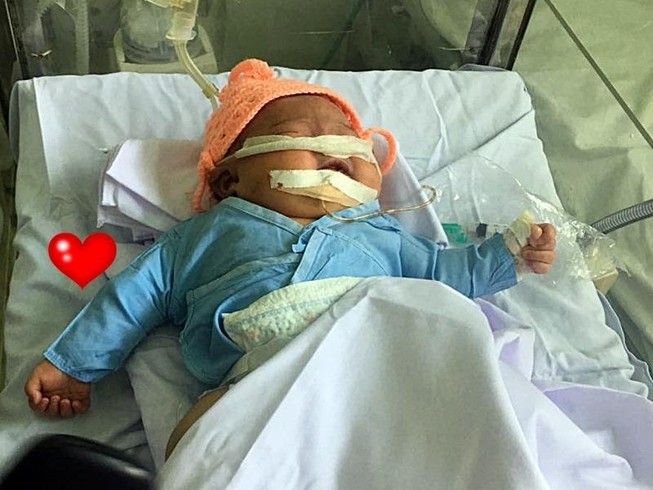 Hơn 200 triệu đồng giúp bé gái gãy tay, ngạt thở sau sinh