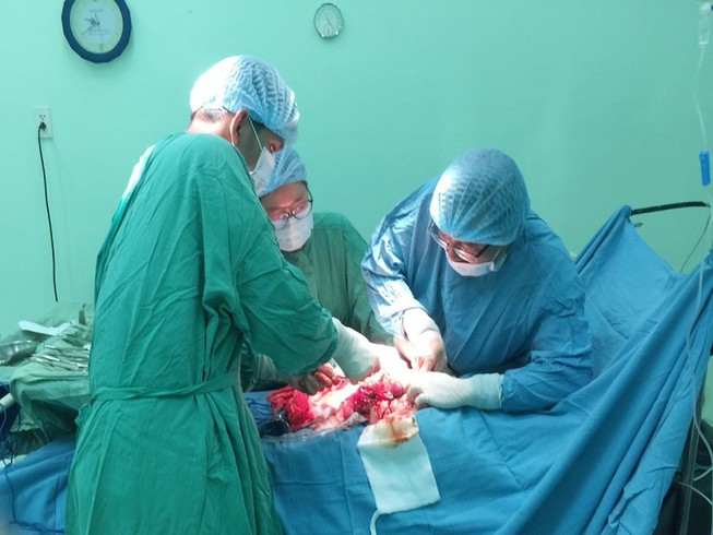 Cứu người phụ nữ mang khối u xơ 'khủng' nặng gần 6 kg