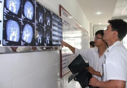 Cứu sống bệnh nhân bị đột quỵ não, liệt toàn thân
