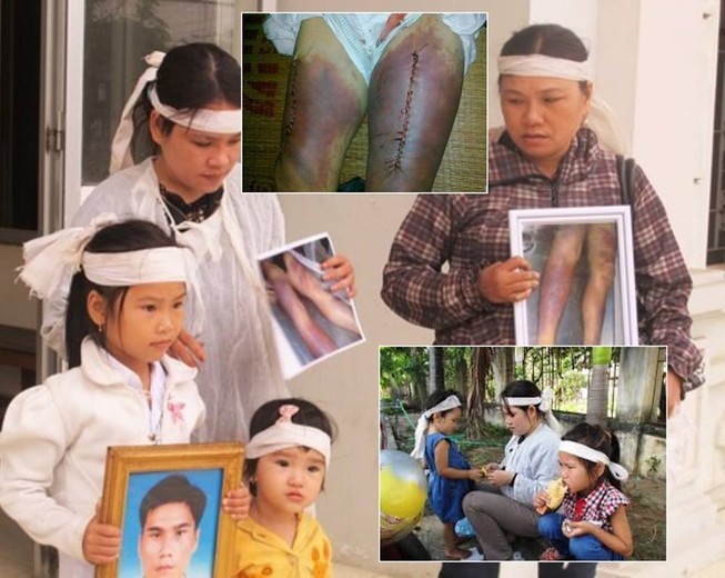 Ai giúp dân chứng minh đã bị công an đánh?